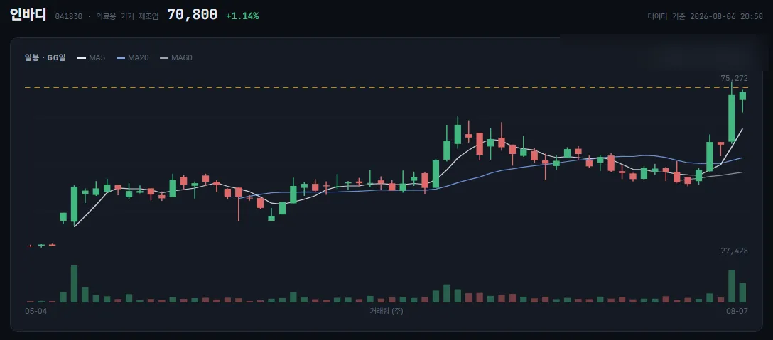 인바디 일봉 차트